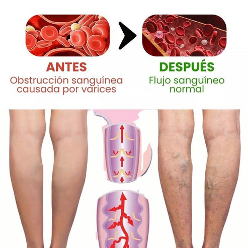 🌟 SUPER COMBO ALIVIO TOTAL: 2 Cremas para Dolores + 1 Crema Varicose Veins 🌟